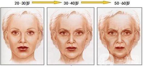 面部下垂如何提升