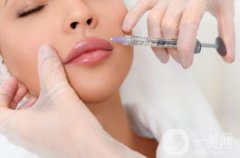 打注射除皱多久见？可以维持多久呢？
