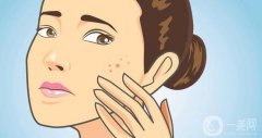干货：如何去痘疤?