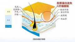 激光修复疤痕的副作用？对凹陷疤痕*吗？