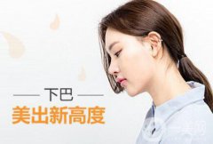 假体下巴风险有哪些？做完能管多久