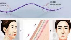 过了25岁该怎么办？抗衰方式分享