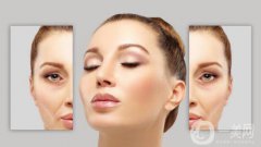 脸部哪里容易长皱纹？脸上皱纹怎么去除