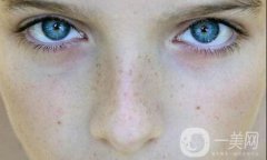 黑头和白头：有什么区别？