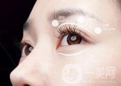 割双眼皮有哪些风险？有失败的吗？