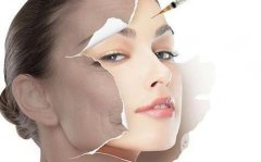 打玻尿酸的危害？不打了会反弹吗？