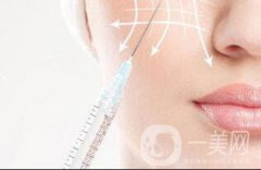 玻尿酸鼻唇沟加重？可能和这些原因有关