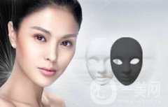 黑脸娃娃去痘印要做几次*？