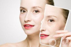 激光嫩肤是如何工作的 激光嫩肤的作用是什么