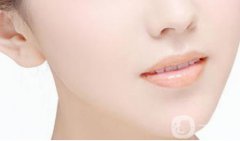 光子嫩肤有什么果?有没有禁忌症?