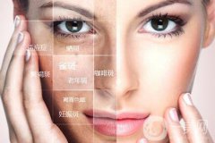 像素激光好吗?有没有危害吗?术后如何护理?