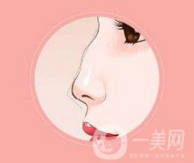 驼峰鼻矫正方法有哪些呢 多久才能恢复正常