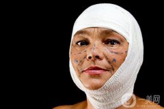 为什么韩国整形率是*TOP1？