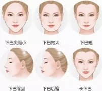 玻尿酸丰下巴打一支好还是两支好？