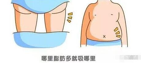 自体脂肪填充副作用及后遗症是什么?