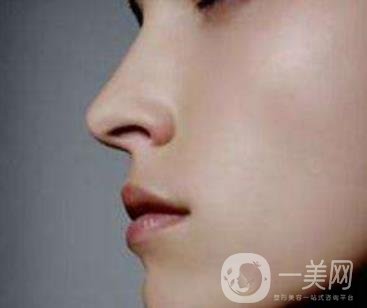 鼻尖美容术方法介绍详情一览