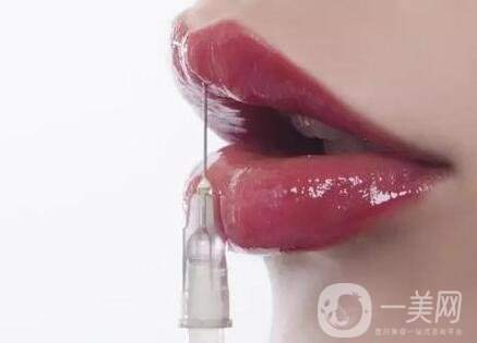 玻尿酸丰唇珠能够保持多久？需要继续注射吗？