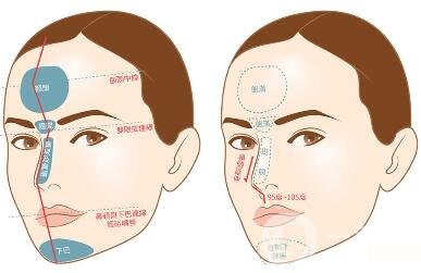 如何让鼻梁变高？可以注射玻尿酸吗？