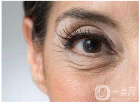 如何减少眼部皱纹？哪些方法比较*？
