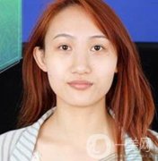 长沙微恩医疗整形医院价格表，附隆鼻真实恢复案例