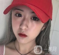 西安叶子整形美容医院价格表，附双眼皮手术真实果展示