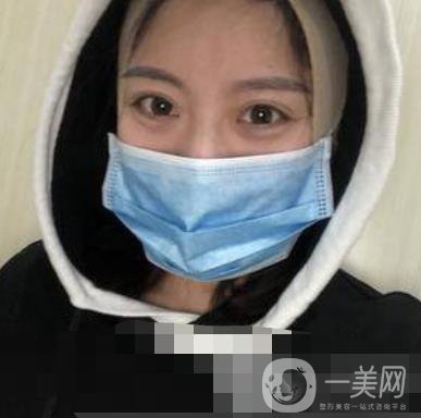 河北省人民医院整形外科价格表新版来袭，附去下颌骨案例