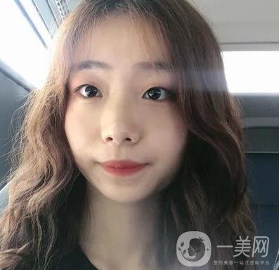 上海华美李志海磨骨多少钱？案例有吗？整形价格表一览