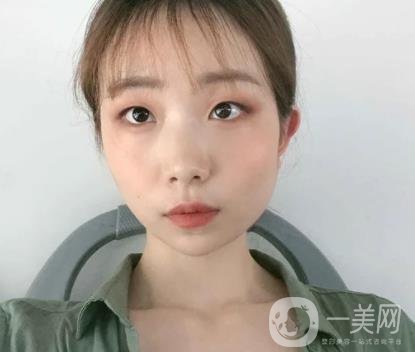 上海华美李志海磨骨多少钱？案例有吗？整形价格表一览