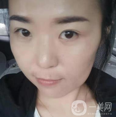 吉大一院整形美容科价格表费用明细，附祛斑案例