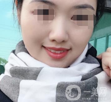 盐城东方女子整形医院价格表_点痣*果一览