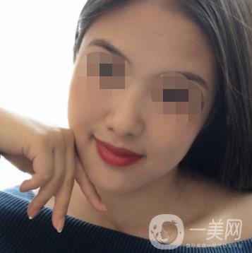 盐城东方女子整形医院价格表_点痣*果一览