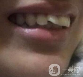 北京医院整牙