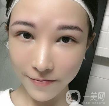 成都华美医院做眉毛怎么样?真实*果图和价格一览表展示