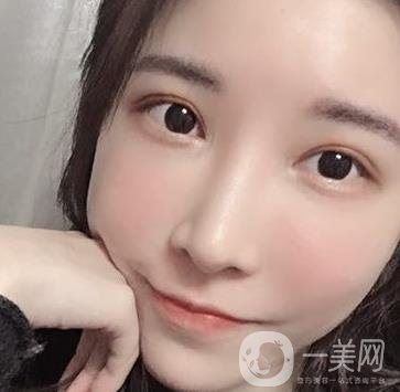 成都华美医院做眉毛怎么样?真实*果图和价格一览表展示