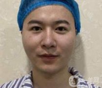 厦门邱健钦医疗美容价格表及隆鼻恢复果展示图