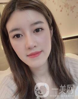 盐城东方女子整形医院价格表明细，附隆鼻案例