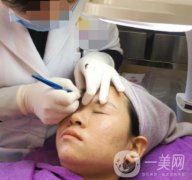 北京医院整形科绣眉果怎么样?2020年价格表日常收费详情一览