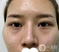 江苏省中医院整形科价格表及自体脂肪填充案例一览