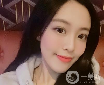 成都美容整形医院做脂肪填充全脸*果靠谱吗?近期价格表和案例参考