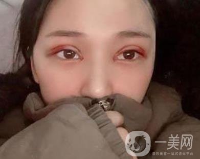 恩施州中心医院美容整形科怎么样？价格表和双眼皮整形经历分享