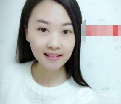 北京市海淀医院口腔科价格表2020更新，附牙齿矫正案例