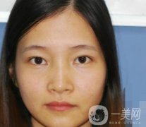 北京朝阳医院整形中心纹眉果怎么样？价格价目表详情一览