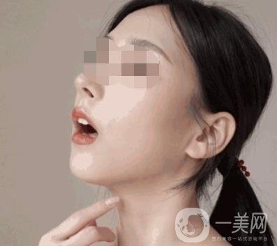 河南省人民医院整形美容科价格表公布，附除腋臭案例