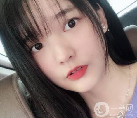 北大口腔医院梁成正颌案例