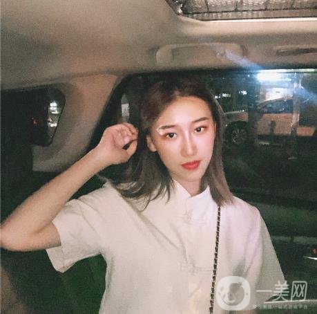 湖南韩美整形医院陈柳艺做鼻子案例