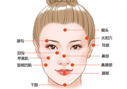 天津伊美尔于广洋主任做了自体脂肪全脸填充，拯救干瘪的脸