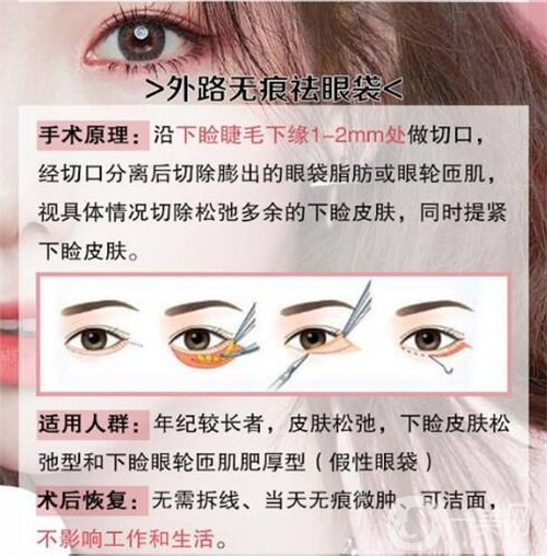 天津医科大学眼科医院做眼袋*果如何?价格价目表2020年全新公布