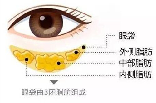 天津医科大学眼科医院做眼袋*果如何?价格价目表2020年全新公布