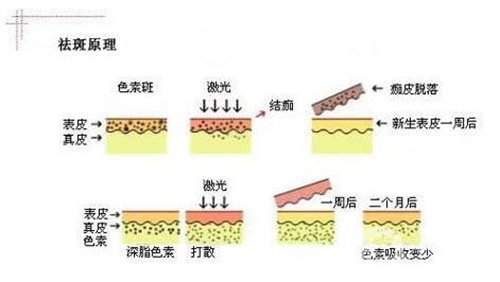 天津医科大学肿瘤医院整形科价格表，附激光祛斑恢复*果图