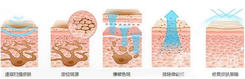 天津医科大学肿瘤医院整形科价格表，附激光祛斑恢复*果图